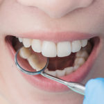 6 Tips for Cavity-Free Holidays