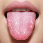 Will cleaning your tongue help reduce the risk of heart disease, arthritis, and other inflammatory diseases?