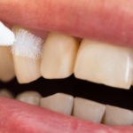 Cleaning between teeth: the secret behind a healthy smile